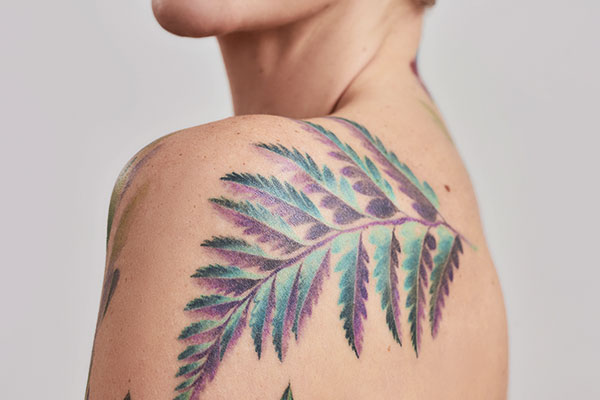 láser de pigmentos para tratamiento de tatuajes